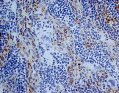Immunohistochemistry-Frozen: Aminopeptidase N/CD13 Antibody (R3-63) [NBP2-23492] - Staining of mouse lymph node cryosection eith Rat anti Mouse antibody clone R3-63  followed by horseradish peroxidase Goat anti Rat IgG antibody. High power   