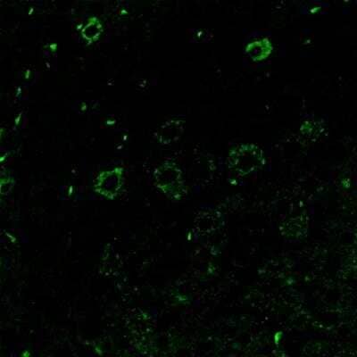Immunohistochemistry: Aminopeptidase N/CD13 Antibody (R3-63) [NBP2-23492] - Staining can be observed in normal mouse liver (Green). Image from a verified customer review.