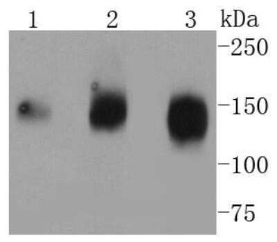 Western Blot: Aminopeptidase N/CD13 Antibody (SC70-01) [NBP2-67602] - Analysis of CD13 on different lysates using anti-CD13 antibody at 1/1,000 dilution. Positive control: Lane 1: THP-1 Lane 2: human heart Lane 3: U937