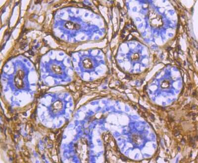 Immunohistochemistry-Paraffin: Aminopeptidase N/CD13 Antibody (SN71-04) [NBP2-67696] - Analysis of paraffin-embedded human breast tissue using anti-CD13 antibody. Counter stained with hematoxylin.