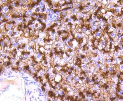 Immunohistochemistry-Paraffin: Aminopeptidase N/CD13 Antibody (SN71-04) [NBP2-67696] - Analysis of paraffin-embedded human liver tissue using anti-CD13 antibody. Counter stained with hematoxylin.