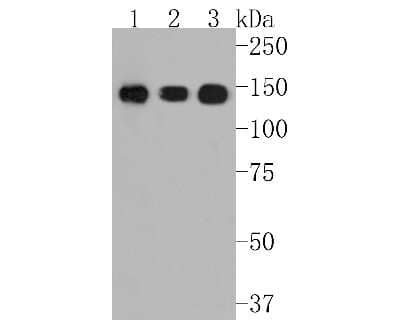 Western Blot: Aminopeptidase N/CD13 Antibody (SN71-04) [NBP2-67696] - Western blot analysis of Aminopeptidase N/CD13 on different lysates. Proteins were transferred to a PVDF membrane and blocked with 5% BSA in PBS for 1 hour at room temperature. The primary antibody (1/500) was used in 5% BSA at room temperature for 2 hour
