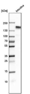 Western Blot: Aminopeptidase N/CD13 Antibody [NBP2-33855] - Analysis in human small intestine tissue.