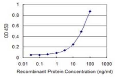 Sandwich ELISA: Aminopeptidase PILS/ARTS1 Antibody (4H8) [H00051752-M01] - Detection limit for recombinant GST tagged ERAP1 is 0.3 ng/ml as a capture antibody.