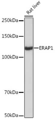 Western Blot: Aminopeptidase PILS/ARTS1 Antibody (6V8C0) [NBP3-16626] - Western blot analysis of extracts of Rat liver, using Aminopeptidase PILS/ARTS1 Rabbit mAb (NBP3-16626) at 1:1000 dilution. Secondary antibody: HRP Goat Anti-Rabbit IgG (H+L) at 1:10000 dilution. Lysates/proteins: 25ug per lane. Blocking buffer: 3% nonfat dry milk in TBST. Detection: ECL Basic Kit. Exposure time: 30s.