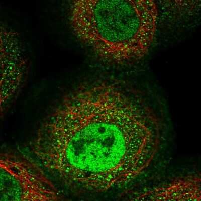 Immunocytochemistry/Immunofluorescence: Aminopeptidase PILS/ARTS1 Antibody [NBP2-59005] - Staining of human cell line A-431 shows localization to nucleoplasm, plasma membrane & cytosol.