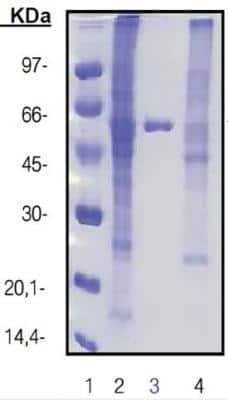 Amintra (R) Cobalt NTA Resin [ACO0025] - Amintra (R) Cobalt NTA Resin [ACO0010] - Crude extract (lane 2) containing HIS-tagged glutaryl acylase (left) and HIS-tagged fucolose-1-aldolase (right) were batch purified using Amintra NiHIS resin (lane 3) and a competitor resin (lane 4). Amintra resin provides higher purity and yield compared to the competitor resin.