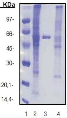 Western Blot: Amintra (R) Cobalt NTA Resin [ACO0010] - Crude extract (lane 2) containing HIS-tagged glutaryl acylase (left) and HIS-tagged fucolose-1-aldolase (right) were batch purified using Amintra NiHIS resin (lane 3) and a competitor resin (lane 4). Amintra resin provides higher purity and yield compared to the competitor resin.