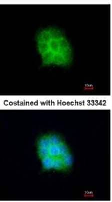 Immunocytochemistry/Immunofluorescence: Amisyn Antibody [NBP2-15376] - Analysis of methanol-fixed A431, using antibody at 1:200 dilution.
