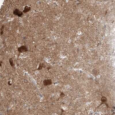<b>Orthogonal Strategies Validation. </b>Immunohistochemistry-Paraffin: Amisyn Antibody [NBP1-90175] - Staining of human lateral ventricle shows strong positivity in neuronal cells.