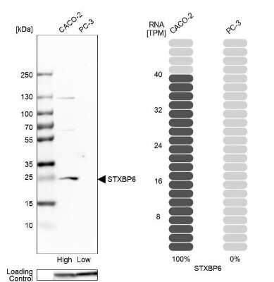 Western Blot Amisyn Antibody - BSA Free