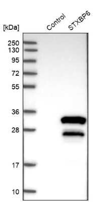Western Blot: Amisyn Antibody [NBP1-90175] - Analysis in control (vector only transfected HEK293T lysate) and STXBP6 over-expression lysate (Co-expressed with a C-terminal myc-DDK tag (3.1 kDa) in mammalian HEK293T cells).