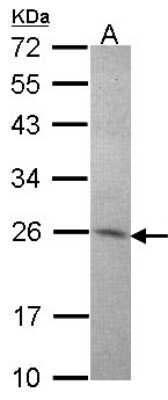 Western Blot: Amisyn Antibody [NBP2-15376] - Sample (30 ug of whole cell lysate) A: Hep G2 12% SDS PAGE; antibody diluted at 1:1000.