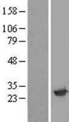 Western Blot: Amisyn Overexpression Lysate (Adult Normal) [NBL1-16589] Left-Empty vector transfected control cell lysate (HEK293 cell lysate); Right -Over-expression Lysate for Amisyn.