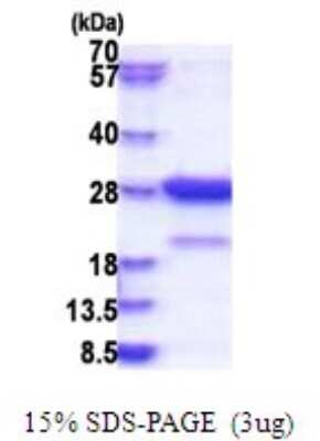 SDS-Page: Amisyn Recombinant Protein [NBP2-51792] - 15% SDS Page (3 ug)