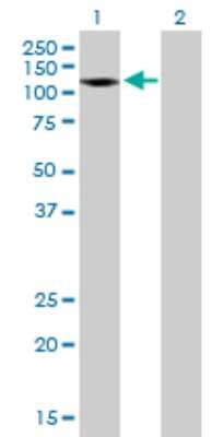 Western Blot: Amphiphysin/AMPH Antibody [H00000273-B01P] - Analysis of AMPH expression in transfected 293T cell line by AMPH polyclonal antibody.  Lane 1: AMPH transfected lysate(76.45 KDa). Lane 2: Non-transfected lysate.