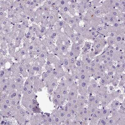 Immunohistochemistry-Paraffin: Amphiregulin Antibody [NBP1-87071] - Staining of human liver shows no positivity in hepatocytes, as expected.