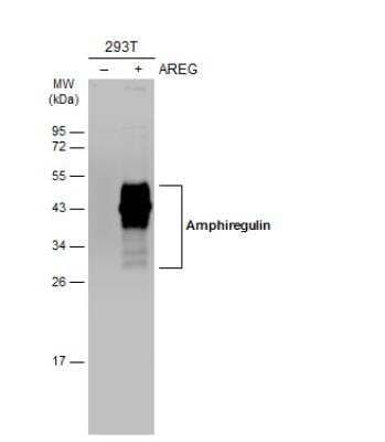 Western Blot: Amphiregulin Antibody [NBP2-15379] - Non-transfected (-) and transfected (+) 293T whole cell extracts (30 ug) were separated by 12% SDS-PAGE, and the membrane was blotted with Amphiregulin antibody diluted at 1:3000. The HRP-conjugated anti-rabbit IgG antibody (NBP2-19301) was used to detect the primary antibody.