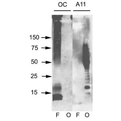 Western Blot: Amyloid Fibrils Antibody [NBP1-97929] - Western blot analysis of Human Abeta42 fibrils and prefibrillar oligomers showing detection of Amyloid Fibrils Fibrils (OC) protein using Rabbit Anti-Amyloid Fibrils Fibrils (OC) Polyclonal Antibody (NBP1-97929). Primary Antibody: Rabbit Anti-Amyloid Fibrils Fibrils (OC) Polyclonal Antibody (NBP1-97929) at 1:1000. Courtesy of: Kayed, R., Head, E., Thompson, J. L., McIntire, T. M., Milton, S. C., Cotman, C. W., et al. (2003). Common structure of soluble amyloid oligomers implies common mechanism of pathogenesis. Science 300, 486-489. doi: 10.1126/science.1079469.