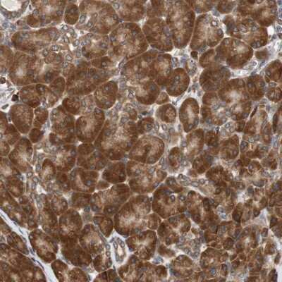 Immunohistochemistry-Paraffin Ancient ubiquitous protein 1 Antibody