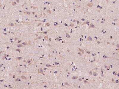 Immunohistochemistry-Paraffin: Ancient ubiquitous protein 1 Antibody [NBP3-06403] - Immunochemical staining of human AUP1 in human brain with rabbit polyclonal antibody at 1:100 dilution, formalin-fixed paraffin embedded sections.