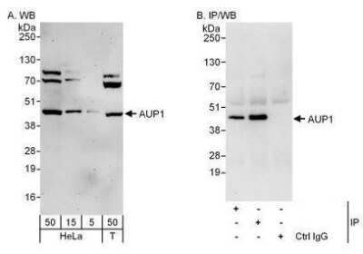 Western Blot Ancient ubiquitous protein 1 Antibody