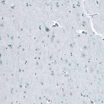 Immunohistochemistry-Paraffin: Androgen R/NR3C4 Antibody (CL9255) [NBP2-88922] - Staining of human cerebral cortex shows no positivity in neurons as expected.