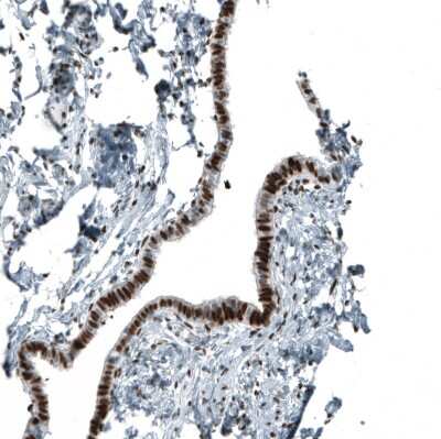 Immunohistochemistry-Paraffin: Androgen R/NR3C4 Antibody (CL9255) [NBP2-88922] - Staining of human Fallopian tube shows strong nuclear positivity in glandular cells.