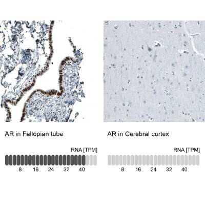 Immunohistochemistry-Paraffin: Androgen R/NR3C4 Antibody (CL9255) [NBP2-88922] - Analysis in human fallopian tube and cerebral cortex tissues using NBP2-88922 antibody. Corresponding AR RNA-seq data are presented for the same tissues.