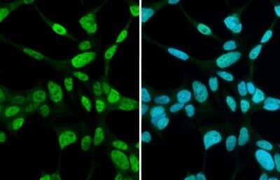 Immunocytochemistry/Immunofluorescence: Androgen R/NR3C4 Antibody [NBP2-15384] - LNCap cells were fixed in 4% paraformaldehyde at RT for 15 min. Green: Androgen Receptor stained by Androgen Receptor antibody [N1], N-term  diluted at 1:2000. 