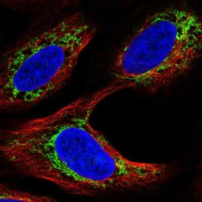 Immunocytochemistry/Immunofluorescence: Androgen R/NR3C4 Antibody [NBP2-55999] - Staining of human cell line U-2 OS shows localization to mitochondria.
