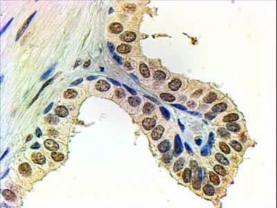 Immunohistochemistry-Paraffin: Androgen R/NR3C4 Antibody [NB100-1446] - (2ug/ml) staining of paraffin embedded Human Prostate. Steamed antigen retrieval with citrate buffer pH 6, AP-staining.