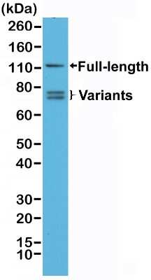 Western Blot: Androgen R/NR3C4 Antibody (RM254) [NBP2-61492] - Western Blot analysis of 22RV1 whole cell lysates, using Anti-Androgen R/NR3C4 (N-term) Rabbit monoclonal antibody (NBP2-61492), showed full length androgen receptor and splice variants expressed in 22RV1 cells.