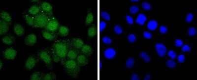 Immunocytochemistry/Immunofluorescence: Androgen R/NR3C4 Antibody (ST0453) [NBP2-67497] - Staining Androgen receptor in MCF-7 cells (green). The nuclear counter stain is DAPI (blue). Cells were fixed in paraformaldehyde, permeabilised with 0.25% Triton X100/PBS.