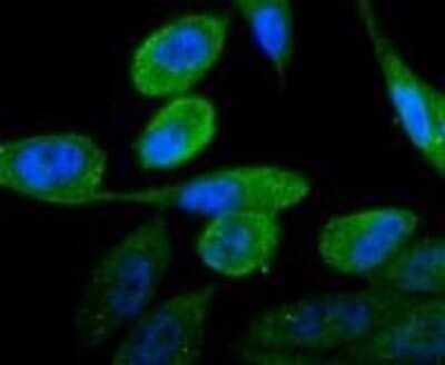 Immunocytochemistry/Immunofluorescence: Androgen R/NR3C4 Antibody (ST0453) [NBP2-67497] - Staining Androgen receptor in PC-3M cells (green). The nuclear counter stain is DAPI (blue). Cells were fixed in paraformaldehyde, permeabilised with 0.25% Triton X100/PBS.