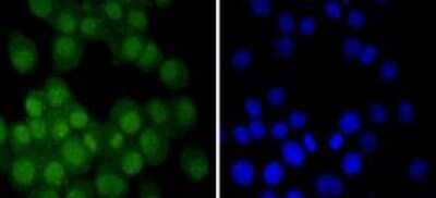 Immunocytochemistry/Immunofluorescence: Androgen R/NR3C4 Antibody (ST0453) [NBP2-67497] - Staining Androgen receptor in N2A cells (green). The nuclear counter stain is DAPI (blue). Cells were fixed in paraformaldehyde, permeabilised with 0.25% Triton X100/PBS.