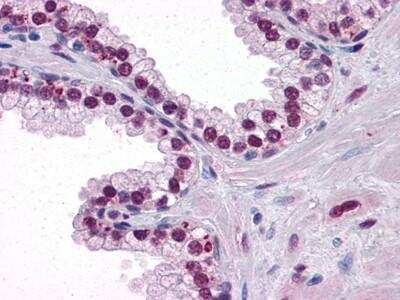 Immunohistochemistry-Paraffin: Androgen R/NR3C4 Antibody (2H8) [NBP1-47471] - Analysis of paraffin-embedded human Prostate tissues using Androgen Receptor mouse mAb