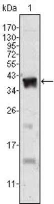 Western Blot: Androgen R/NR3C4 Antibody (2H8) [NBP1-47471] - Analysis using Androgen Receptor mouse mAb against human recombinant Androgen Receptor.