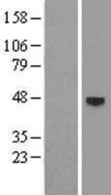 Western Blot: Androgen R/NR3C4 Overexpression Lysate [NBL1-07644] - Left-Empty vector transfected control cell lysate (HEK293 cell lysate); Right -Over-expression Lysate for Androgen Receptor.