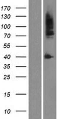 Western Blot: Androgen R/NR3C4 Overexpression Lysate [NBP2-04146] -  Left-Empty vector transfected control cell lysate (HEK293 cell lysate); Right -Over-expression Lysate for Androgen Receptor.