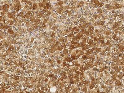 Immunohistochemistry-Paraffin: Angiogenin Antibody [NBP2-98773] - Immunochemical staining of human Angiogenin in human liver with rabbit polyclonal antibody (1:1000, formalin-fixed paraffin embedded sections).