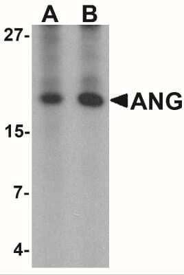 Western Blot: Angiogenin Antibody [NBP2-41185] - Analysis of ANG in rat liver tissue lysate with Ang antibody at (A) 1 and (B) 2 ug/mL.