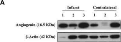 Western Blot: Angiogenin Antibody [NBP2-41185] - Angiogenin and EPCs modulation after human stroke and rehabilitation. (A) Infarct tissue and contralateral brain homogenates (less than or equal 4 days) were analyzed by western blot for angiogenin (n = 3). The densitometry results (arbitrary units) were corrected by the actin load and bar graph showing the angiogenin fold-change of the ipsilateral vs. contralateral signal. Image collected and cropped by CiteAb from the following publication (//www.frontiersin.org/article/10.3389/fneur.2018.00508/full) licensed under a CC-BY license.