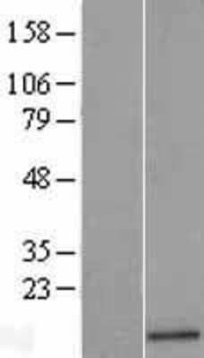 Western Blot: Angiogenin Overexpression Lysate (Adult Normal) [NBP2-10954] Left-Empty vector transfected control cell lysate (HEK293 cell lysate); Right -Over-expression Lysate for Angiogenin.