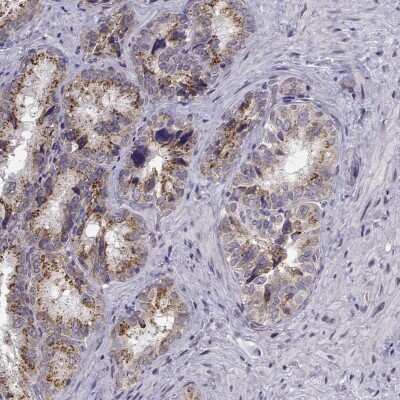 <b>Orthogonal Strategies Validation. </b>Immunohistochemistry-Paraffin: Angiopoietin-1 Antibody [NBP1-90170] - Staining of human seminal vesicle shows high expression.