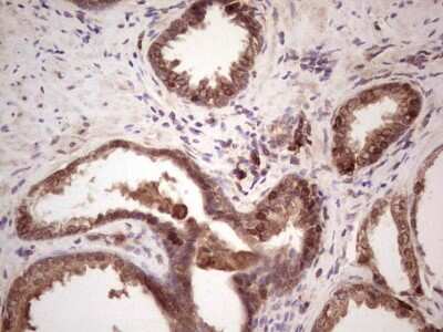 Immunohistochemistry: Angiopoietin-2 Antibody (3H7) [NBP2-46520] - Analysis of Human prostate tissue.