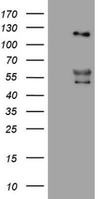 Western Blot: Angiopoietin-2 Antibody (3H7) [NBP2-46520] - Analysis of HEK293T cells were transfected with the pCMV6-ENTRY control (Left lane) or pCMV6-ENTRY Angiopoietin 2.