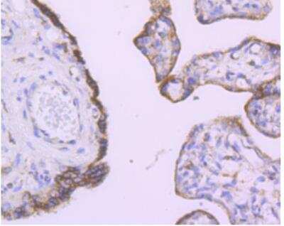 Immunohistochemistry-Paraffin: Angiopoietin-2 Antibody (JM71-34) [NBP2-67154] - Analysis of paraffin-embedded human placenta tissue using anti-Angiopoietin 2 antibody. Counter stained with hematoxylin.