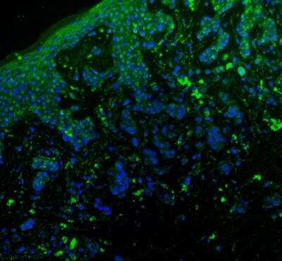 Angiopoietin-2 Antibody (MM0020-1F29) [Alexa Fluor® 488] [NB110-85467AF488] - Ang-2 (green) was detected in human skin (nevus) using Ang2-Alexa Fluor 488 antibody (1:40) in PBS for 1 hour. Nuclei were stained with DAPI (blue). Tissue was fixed with acetone. Image from a verified customer review.