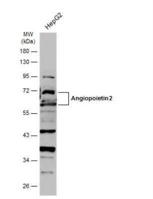 Western Blot: Angiopoietin-2 Antibody [NBP2-15386] - Whole cell extract (30 ug) was separated by 10% SDS-PAGE, and the membrane was blotted with Angiopoietin 2 antibody diluted at 1:1000. The HRP-conjugated anti-rabbit IgG antibody (NBP2-19301) was used to detect the primary antibody.